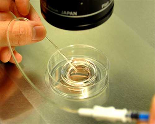 云南家圆医院供卵生男孩费用及生育险报销指南