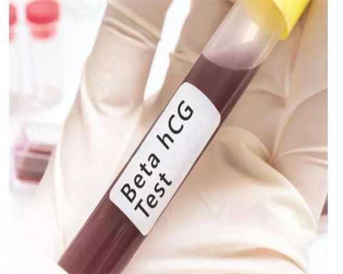 弱精症备孕指南与同房技巧分享，提升精子活力助孕策略