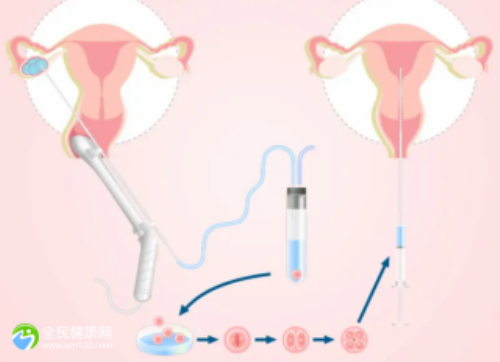 单身赴美生子指南：准备材料与优势解析