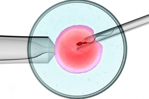 单身女性精子库使用与辅助生殖法律现状