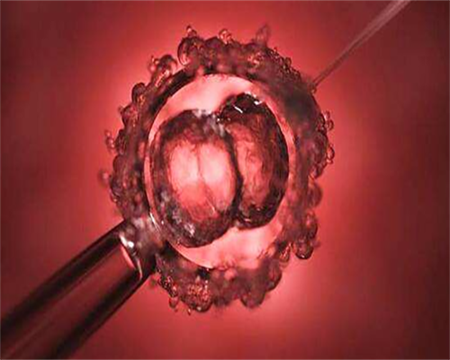 单身试管费用解析与助孕选择指南