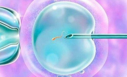 借卵试管助孕的利弊分析与广州试管经历分享
