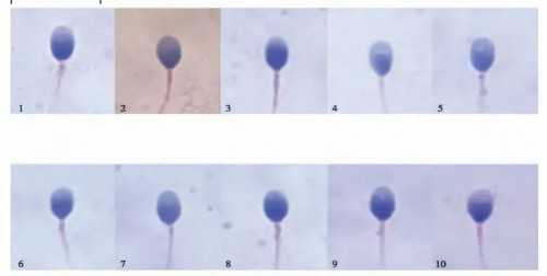 单身女性赴美生子指南：合法途径与费用解析