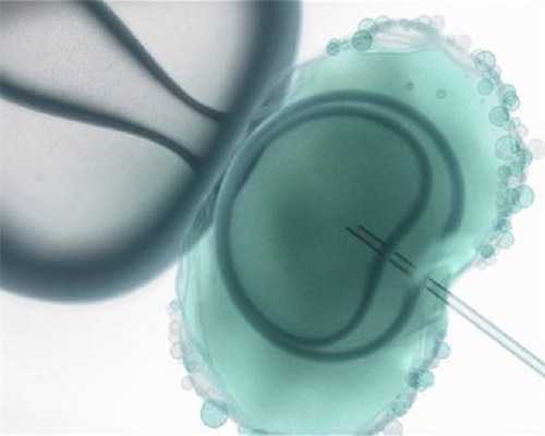 试管移植费用与供卵试管指定服务详解，助孕成本多少